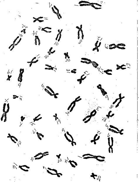 Karyotyping virtual lab activity answer sheet. Karyotype Lab - BIOLOGY JUNCTION