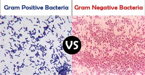 Gram Positive Vs Gram Negative Bacteria 31 Differences With Examples
