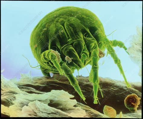 Colour Scanning Electron Micrograph Of A Dust Mite Stock Image Z445