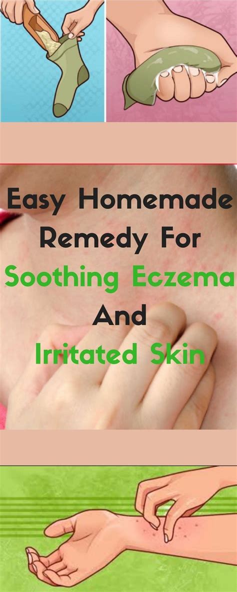 Easy Homemade Remedy For Soothing Eczema And Irritated Skin Health