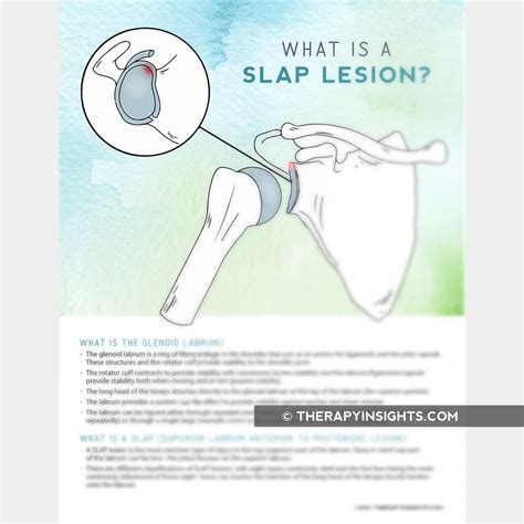 Slap Lesions Adult And Pediatric Printable Resources For Speech And