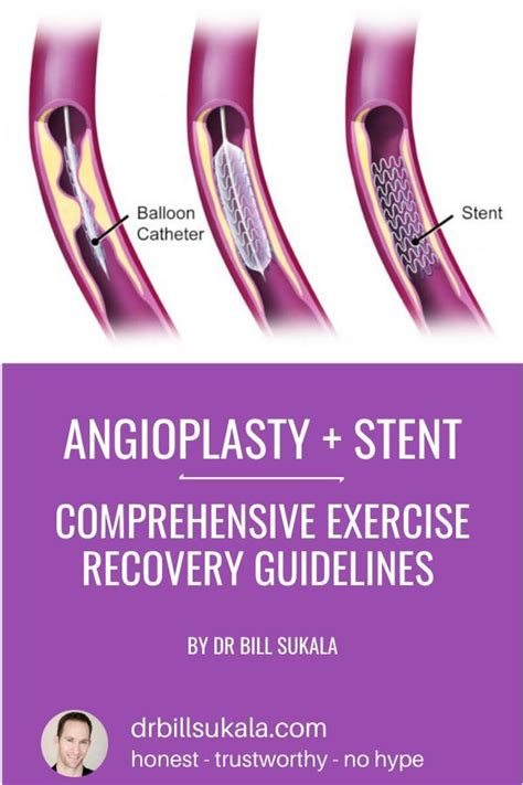 Pin On Angioplasty And Stent