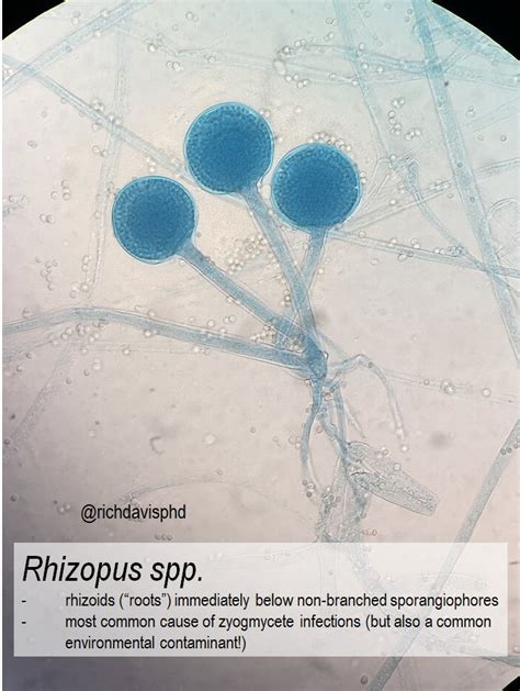 Rhizopus Spp On Microscopy Rhizoids Roots Immediately Grepmed