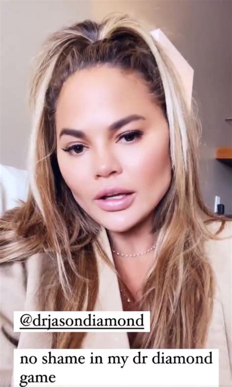 chrissy teigen reveals she had fat removed from her cheeks igbere tv