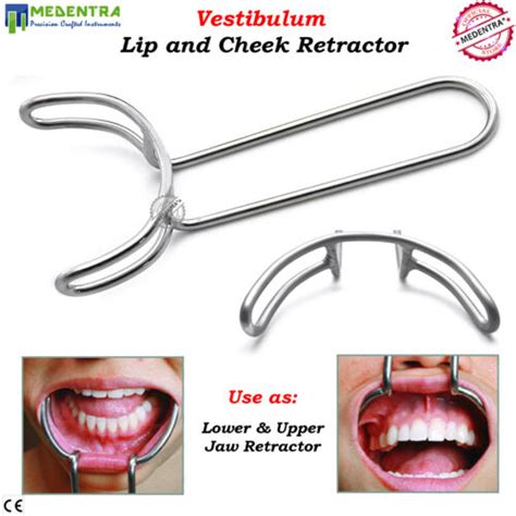 Dentistry Oral Orthodontics Lip Tongue Cheek Rectator Dental Mouth