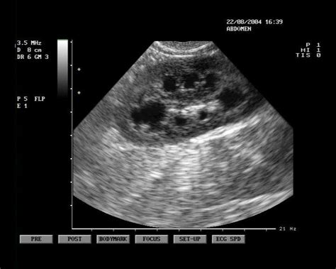 Cat cancer symptoms how do they appear? Ultrasound Image Cheshire Cat Feline Health Center