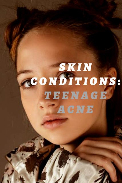 Skin Conditions Teenage Acne
