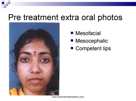 Case Presentationsedtt Dental Implant Courses By Indian Dental Academy