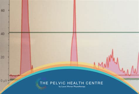 What Is Emg Biofeedback And Rtus Imaging — The Pelvic Health Centre By