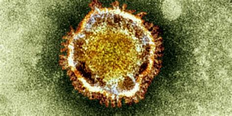 Sars Linked Virus May Have Spread Between People