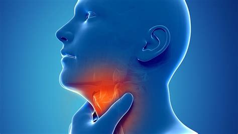 Could Your Sore Throat Be Caused By Silent Reflux Everyday Health
