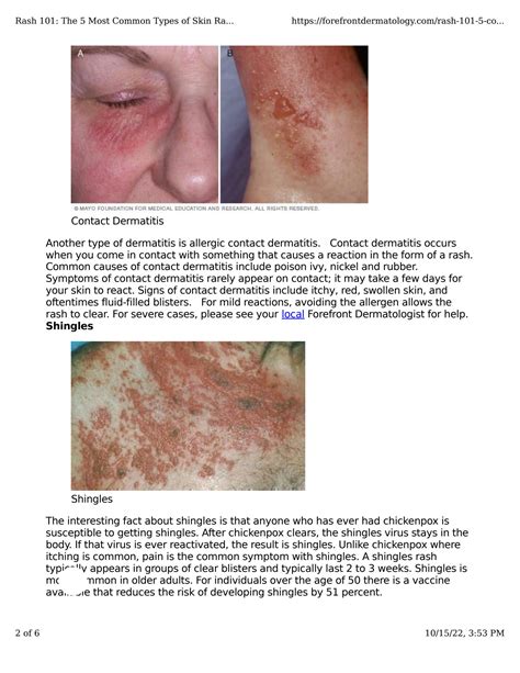 Solution Rash 101 The 5 Most Common Types Of Skin Rashes Studypool