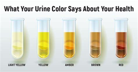 If you have any concerns about the color of your urine, talk with your healthcare provider. What Your Urine Colour Says About Your Health - Read This