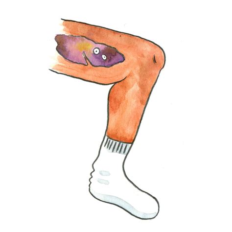 Meet Your Leg Bruises The New Yorker