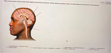 Solved This Cross Section Of The Human Brain Depicts Several