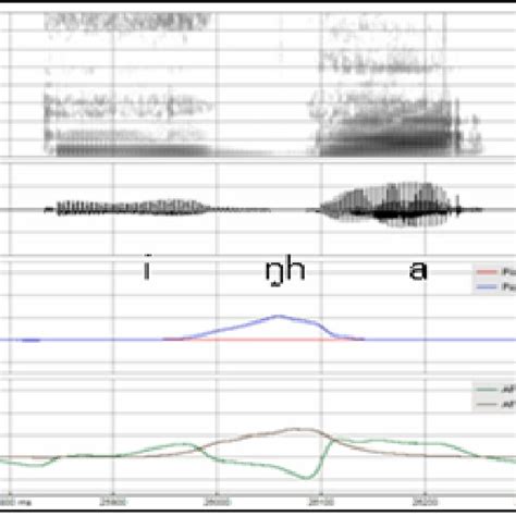Spectrogram Audio Waveform Pspio Oralafo And Nasal Airflow Afn