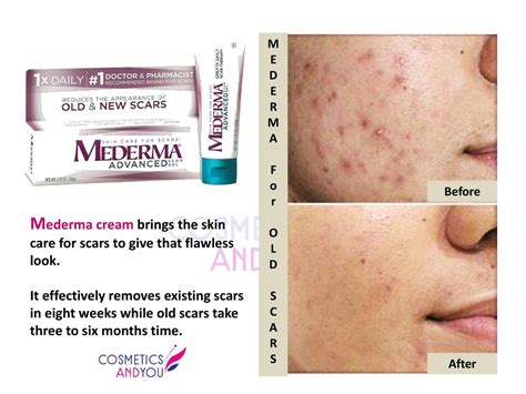 Mederma Reviews For Old Scars Cosmetics And You Acne Treatment Careprost Eyelashes