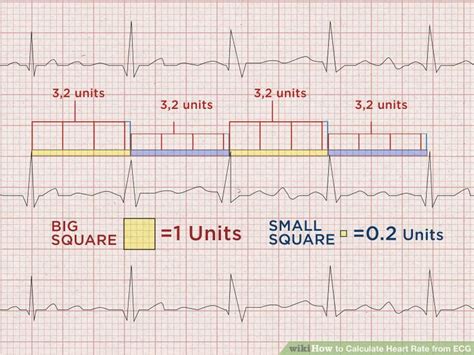 How To Calculate Heart Rate From Ecg Unugtp News