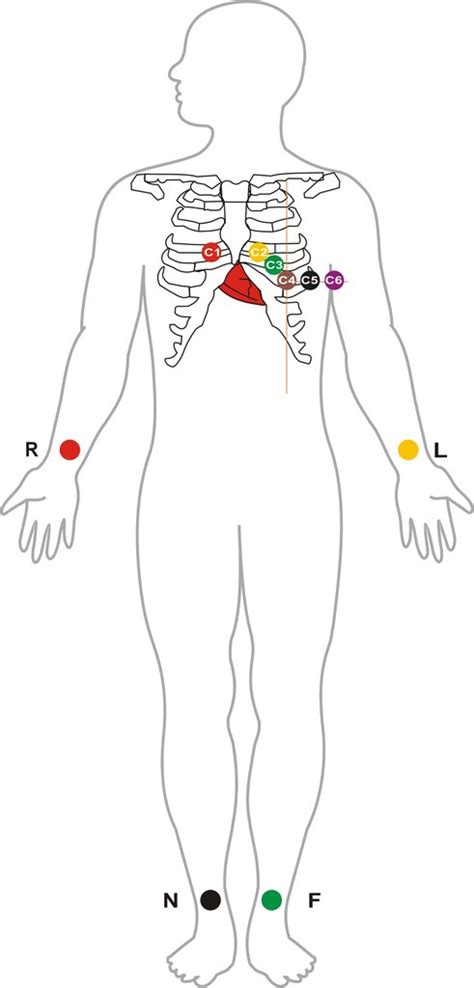 Figure 18 shows how the electrodes. Lead ECG Cable/Electrode Three(3),Five(5),Ten(10)