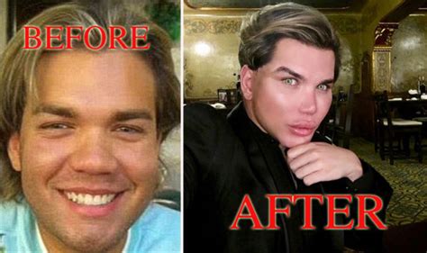 Ken Real Life Before And After