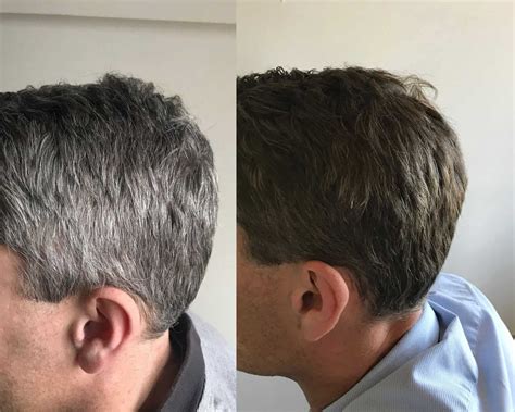 Gr 7 Professional No More Grey Hair Grey Hair Treatment