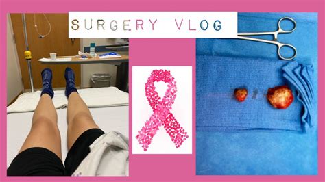 Lumpectomy Surgery Fibroadenoma Removal Youtube