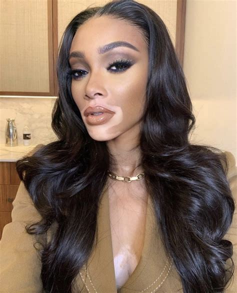 Take A Look At Winnie Harlow As She Celebrates Her Natural Beauty