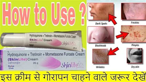 Frade, fradiomycin fradiomycin is also used to reduce the symptoms of hepatic coma. Skinlite cream review // how to use skinlite cream ...