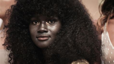 This Model Is Speaking Out About Being Bullied For Having Dark Skin Via Teenvogue Blavity
