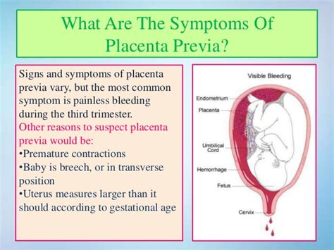 Find out how you'll know if you have placenta previa and what happens if it persists. Placenta Previa- Symptoms, Causes & Treatment
