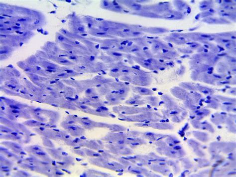 Involuntary) muscle under the microscope in a section of digestive tract. Cardiac Muscle Under Microscope 400x - Micropedia
