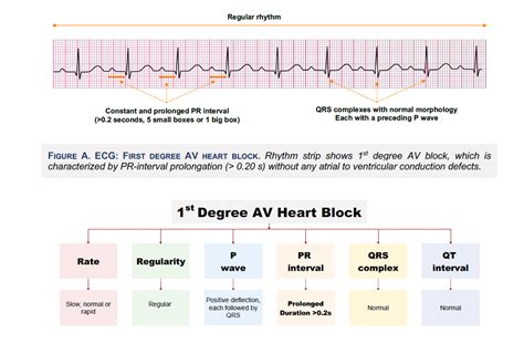 Ekg Interpretation For Step 2 How To Read An Ekg For Step 2