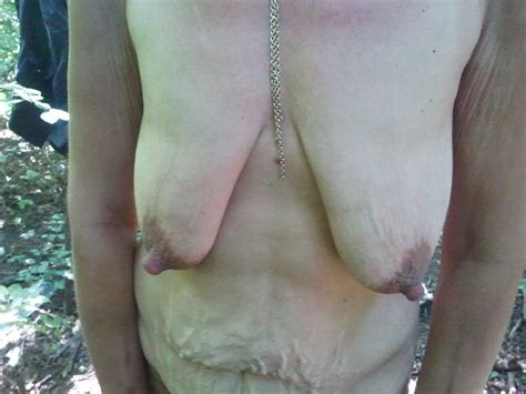 Ugly Homeless Granny In Forest 11 Immagini XHamster