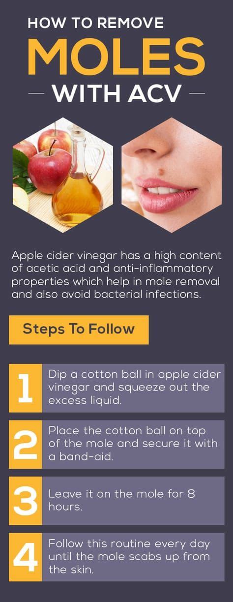 Apple Cider Vinegar Mole Removal Simple Methods That Really Work Apple