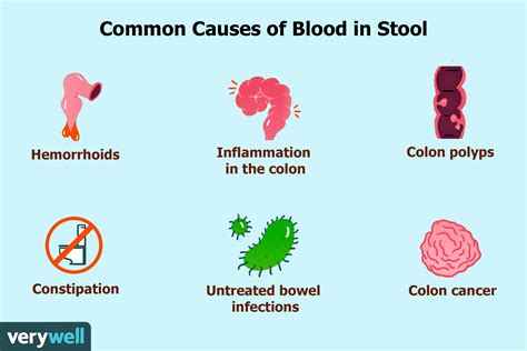 Bright Red Blood In Stool And Rectal Bleeding