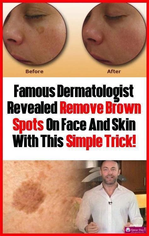 Face recognition is a technique of identification or verification of a person using their faces through an image or a video. Revealed famous dermatologist: Remove Brown Spots On Face And Skin This Simple Trick! # ...