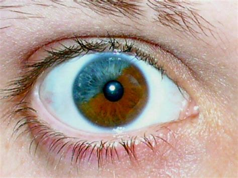 Heterochromia A Gallery On Flickr