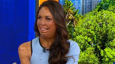 How You Could Run With Turia Pitt