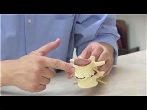 Surgery may be required if a disk fragment lodges in the spinal canal and presses on a nerve, causing significant loss of function. Chiropractic Treatments : How to Repair a Lower Back Herniated Disc - YouTube