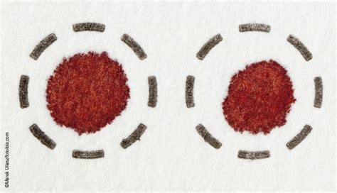 Dried Blood Spots Serology Without Venipuncture Euroimmunblog