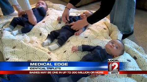 Medical Edge Rare Case Of Identical Triplets Wkrc