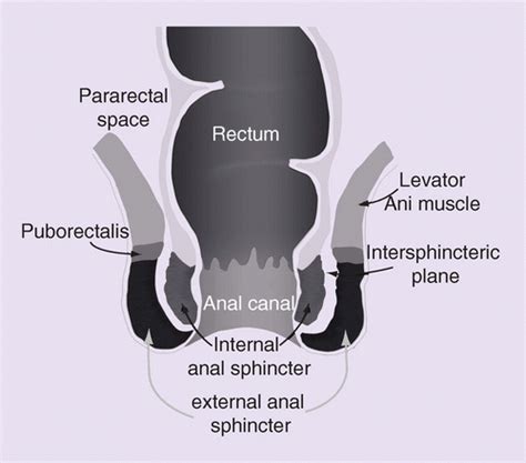 anal sphincter repair