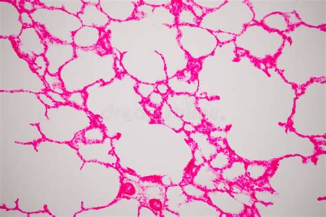 Human Lung Tissue Under Microscope View Stock Image Image Of Bronchi
