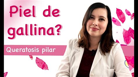 Queratosis Pilar Piel De Gallina Te Cuento Un Resumen Y Algunos Tips