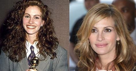 Julia Roberts Before And After Plastic Surgery 37 Celebrity Plastic