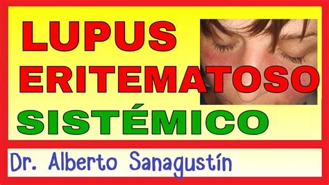 Lupus Eritematoso SistÉmico Les Síntomas Fisiopatología Y