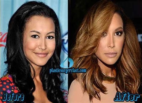 Naya Rivera Plastic Surgery Before And After