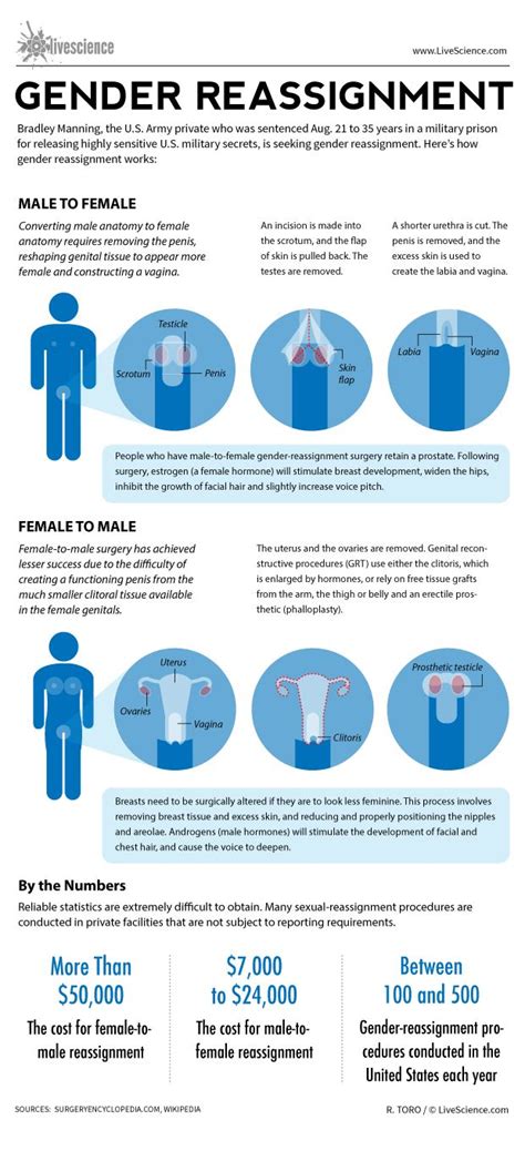 How Gender Reassignment Surgery Works Infographic Live Science