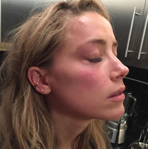 Photo Shows Amber Heards Face After Johnny Depp Threw Phone Daily Mail Online