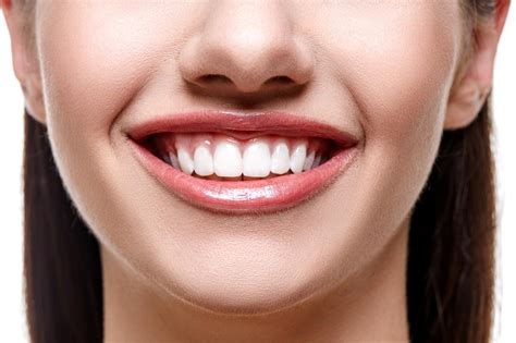Whitening Teeth At Our Dentist Office In Milton Ontario